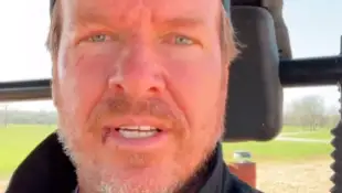 Chip Gaines with an injured face