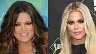These Are The Worst Plastic Surgeries In Hollywood!