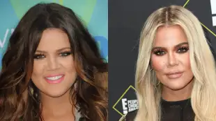 These Are The Worst Plastic Surgeries In Hollywood!