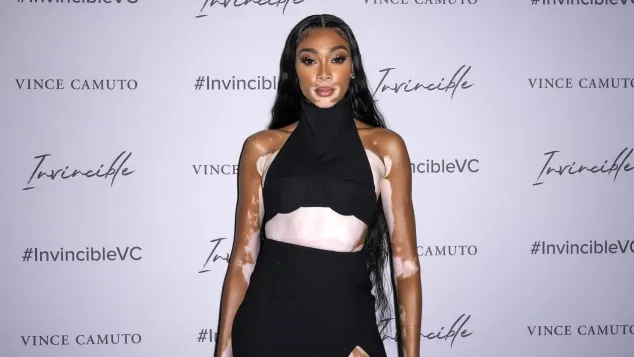 Winnie Harlow