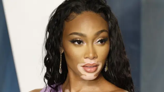 Winnie Harlow