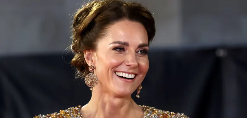 The Reason Behind The Scar On Duchess Kate's Face