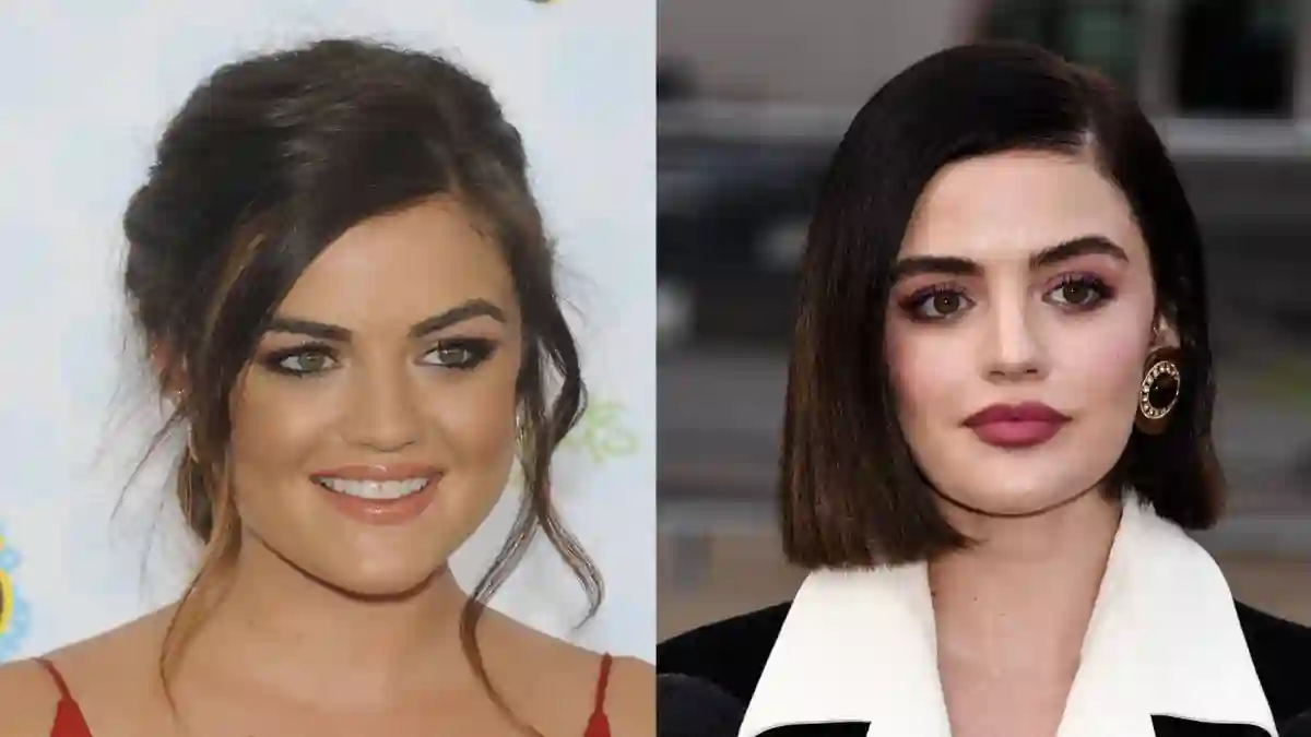These Stars Have Cosmetically Plumped Their Lips