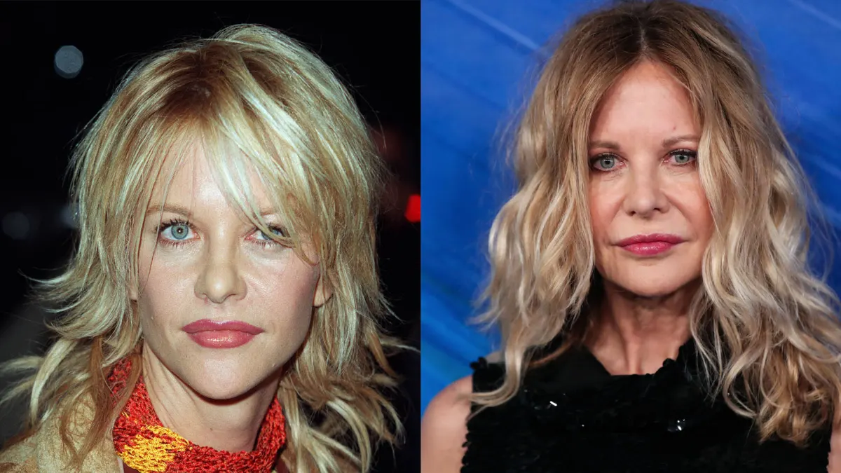 These Stars Have Cosmetically Plumped Their Lips