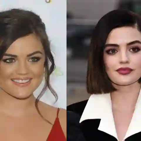 These Stars Have Cosmetically Plumped Their Lips