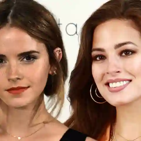 Stars you didn't know had freckles
