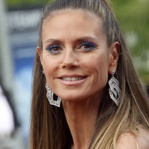 Heidi Klum injured herself on vacation