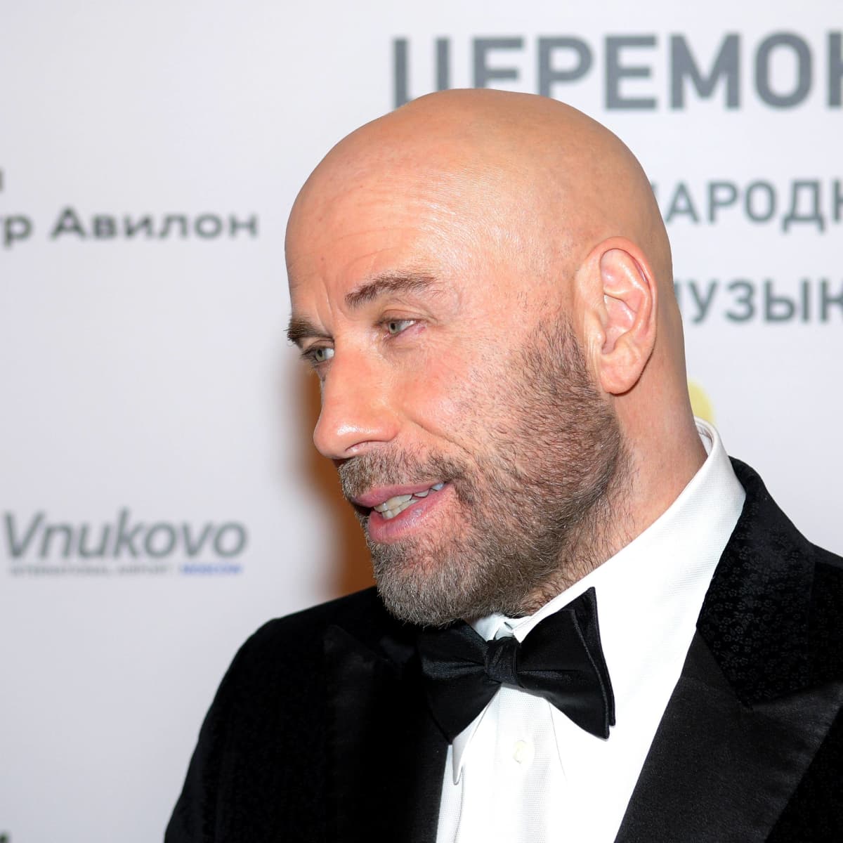 john travolta hair plugs