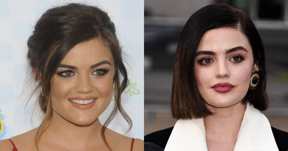 These Stars Have Cosmetically Plumped Their Lips