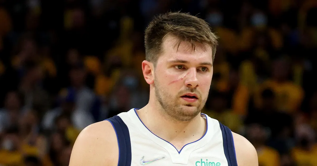 This Is How Luka Doncic Got His Face All Scratched Up