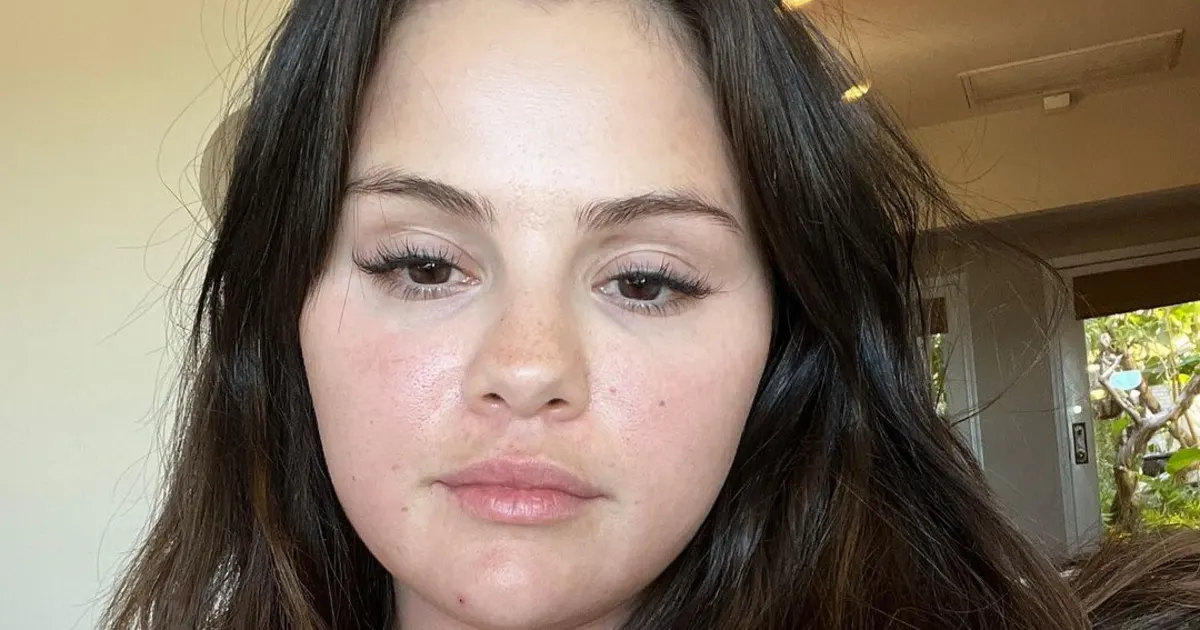 Selena Gomez Shares Rare Makeup Free Selfie!