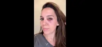 Christy Carlson Romano shot wounded injured