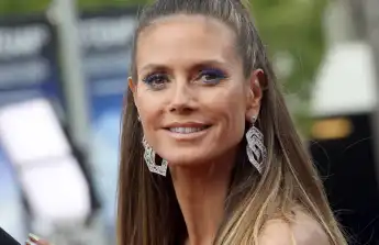 Heidi Klum injured herself on vacation
