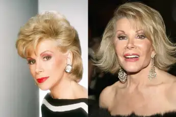 These Are The Worst Plastic Surgeries In Hollywood!