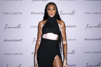 Winnie Harlow beim Vince Camuto Spring 2022 Invincible Pop-up Event. New York, 07.04.2022 *** Winnie Harlow at the Vince