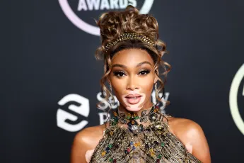 'Winnie Harlow Is All Legs In Dubai! See Her Sexy Vacation Pics Here! - PERFECT! :)