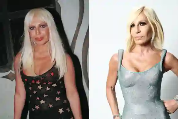 Donatella Versace antes vs. hoy