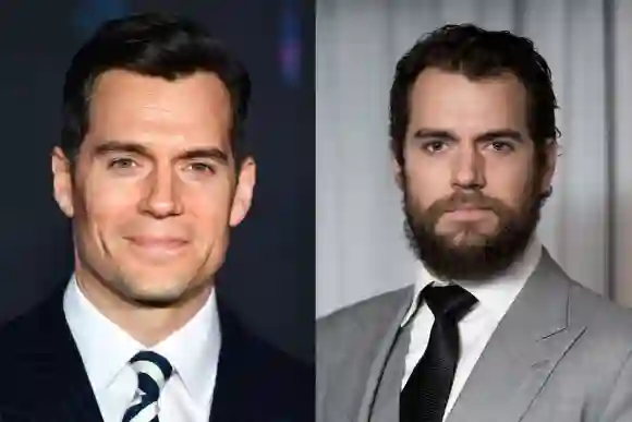 Celebrity Men With and Without A Beard: Which Look Is Better?