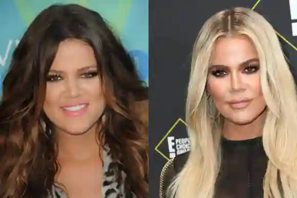 Khloé Kardashian then vs. now