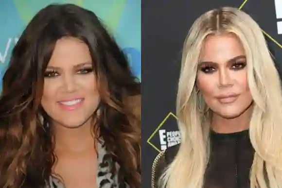 Khloé Kardashian antes vs. ahora