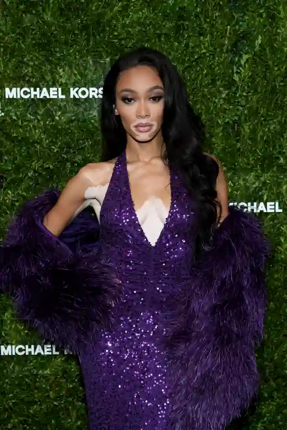 Winnie Harlow attends God's Love We Deliver, Golden Heart Awards on October 21, 2019 in New York City.