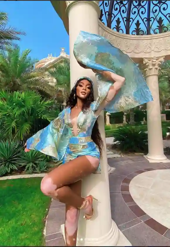 Winnie Harlow Is All Legs In Dubai! See Her Sexy Vacation Pics Here!