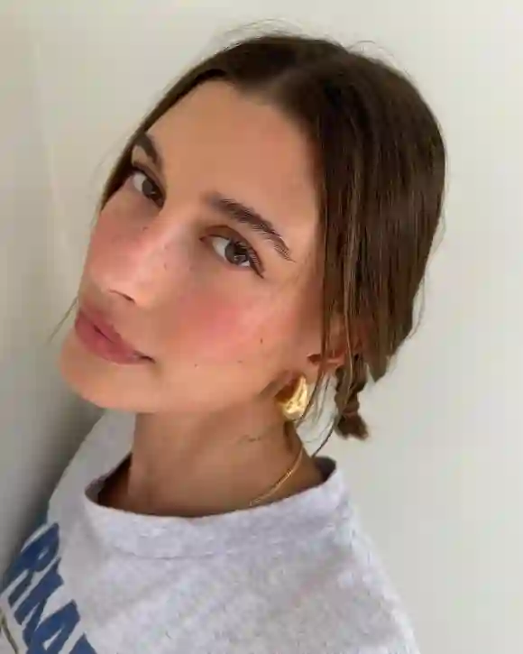 Hailey Bieber freckles