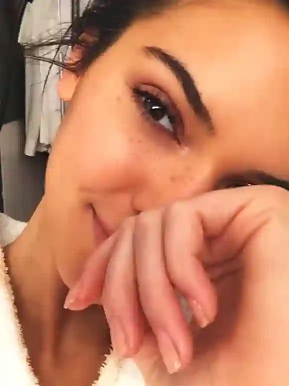 Kendall Jenner con pecas
