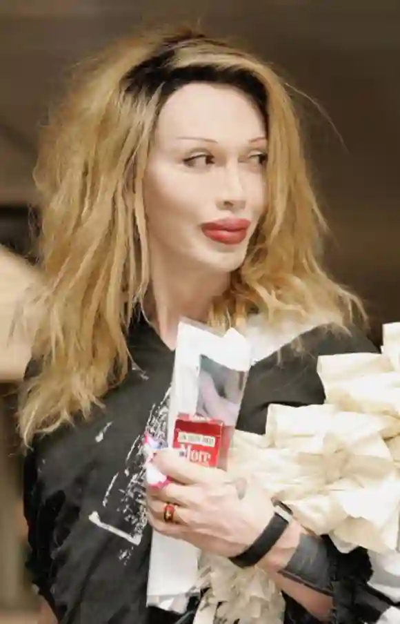 Pete Burns