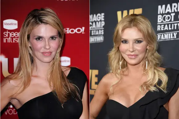 Estas estrellas han rellenado cosméticamente sus labios