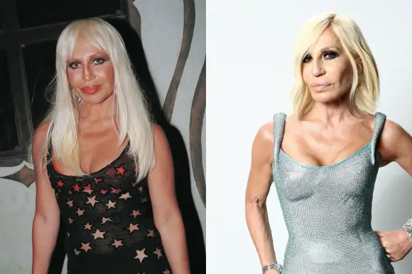 These Are The Worst Plastic Surgeries In Hollywood!