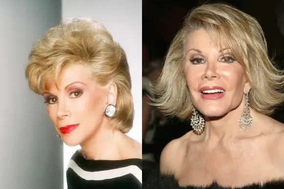 These Are The Worst Plastic Surgeries In Hollywood!