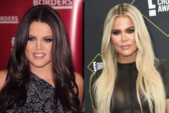 Estas estrellas han rellenado cosméticamente sus labios